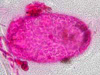 egg112micronMoldEatingMite